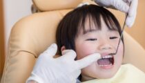 子どもの虫歯を予防したい方におすすめ！シーラントって何？特徴とメリットを紹介